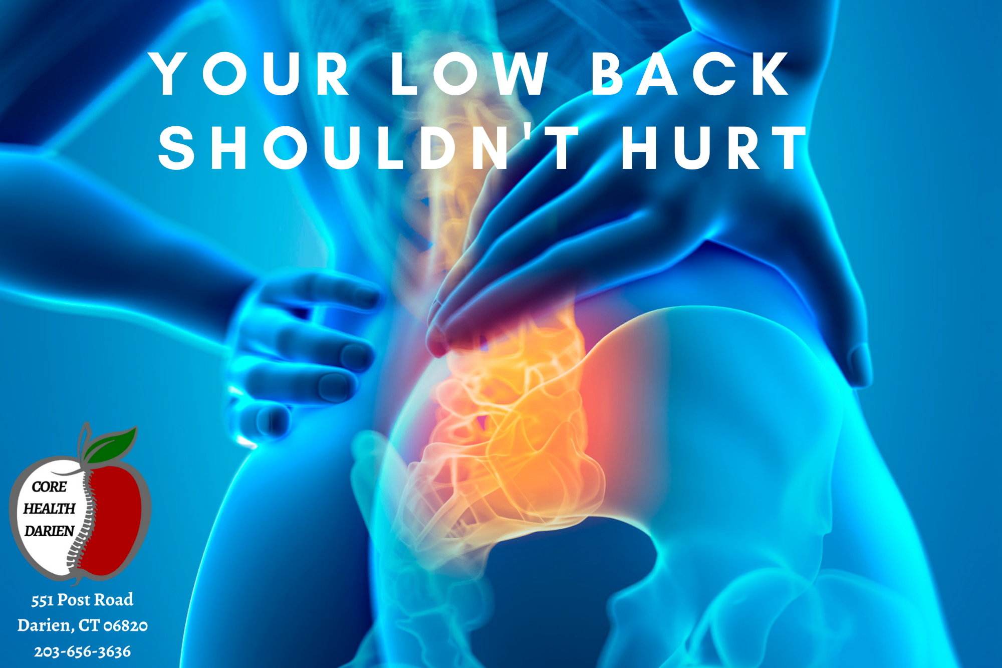 Low Back Pain With Pain Down Back Of Legs